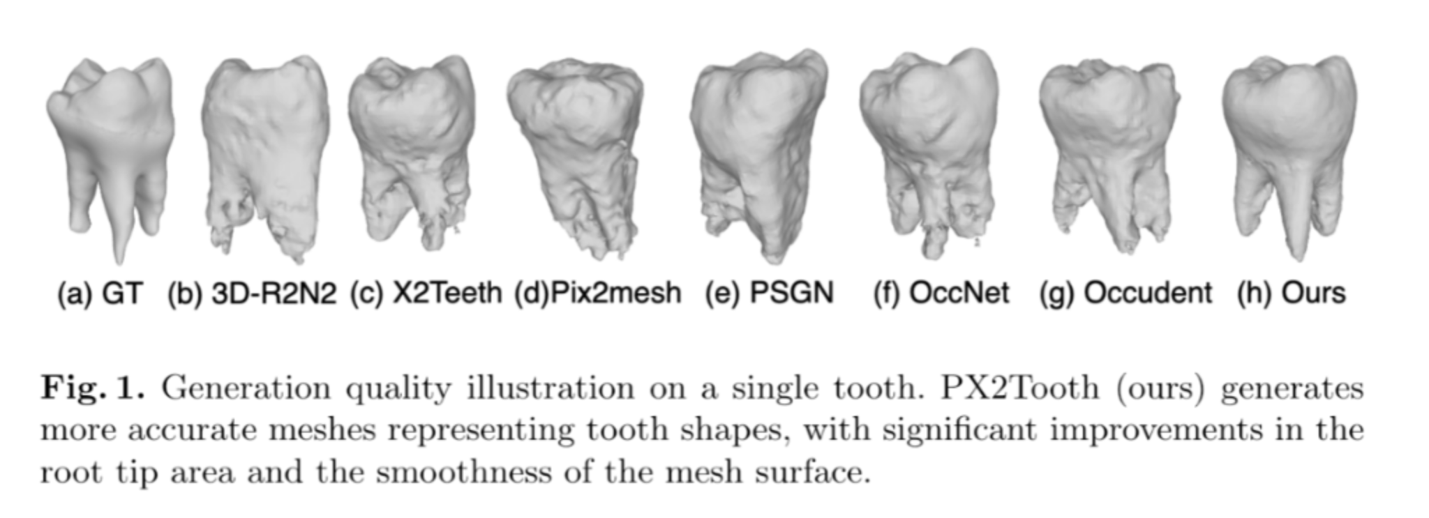 a research paper graphic, showing eight 3d renders of human molar teeth.
they are labelled (a) GT (b) 3D-R2N2 (c) X2Teeth (d) Pix2Mesh (e) PSGN (f) OccNet (g) Occudent (h) Ours

caption text is included in the image. Fig 1. Generation quality illustration on a single tooth. PX2Tooth (ours) generates more accurate meshes representing tooth shapes, with significant improvements in the root tip area and the smoothness of the mesh surface.